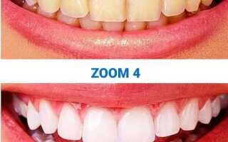 На сколько тонов отбеливает zoom 4