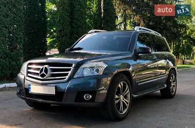 Сколько стоит mercedes glk Сколько стоит mercedes glk
