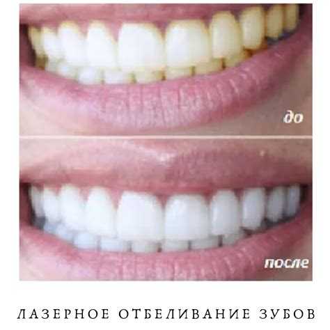 Можно ли употреблять молочные продукты после процедуры