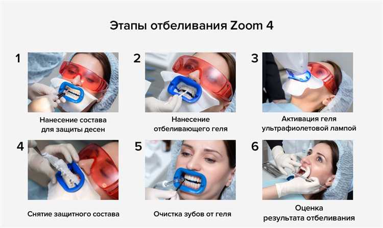 Допустимое количество процедур Zoom 4 в год