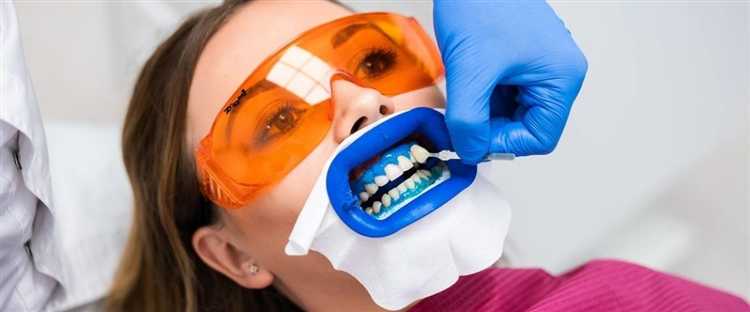 Факторы, влияющие на результат отбеливания системой Zoom 4