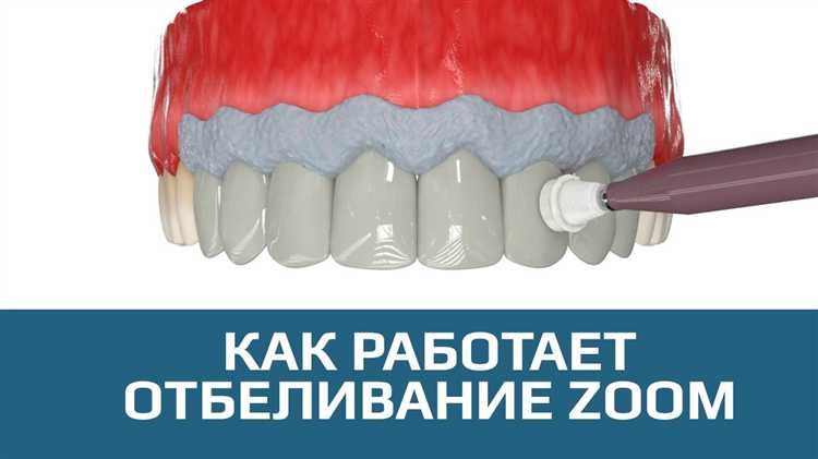 Разница в цене между Zoom 3 и Zoom 4
